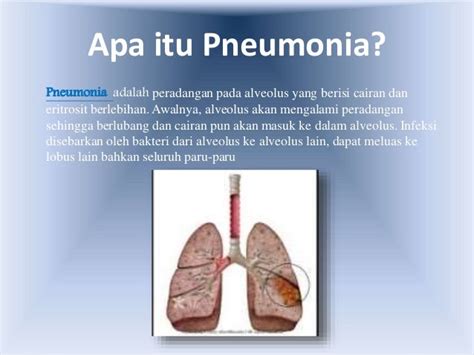 pneumonia adalah penyakit
